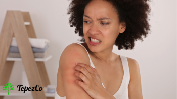 Wie pflegt man Haut mit Ekzemen?